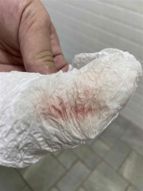 เลือดออกแบบนี้ควรไปหาหมอมั้ย?