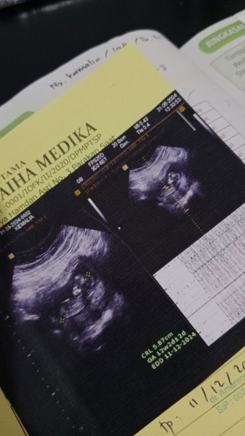 Air ketuban pas-pasan