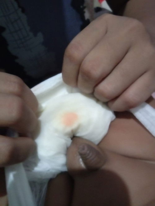 Pipis sedikit dan jarang