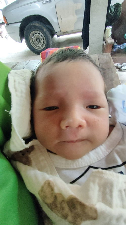 G6PD  ท้องแรกค่ะขอประสบการณ์คนที่มีลูกเป็นโรคนี้แนะนำการดูแลหน่อยค่ะ