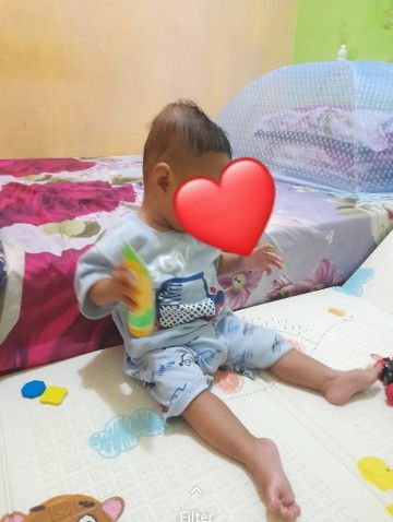 Apakah bentuk kepala bisa kembali normal