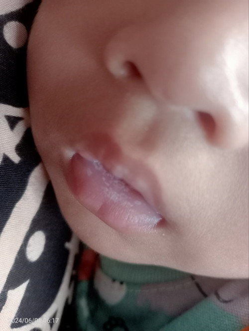 Bibir putih²