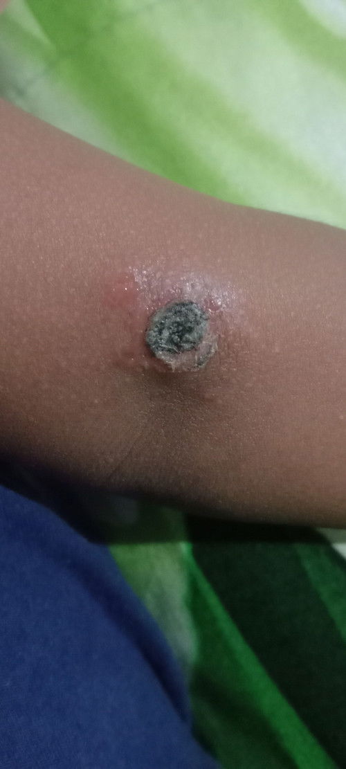 Ada yang pernah alami kah bunda2 awalnya kecil lama2 menjadi besar dan tiap hari d garuk