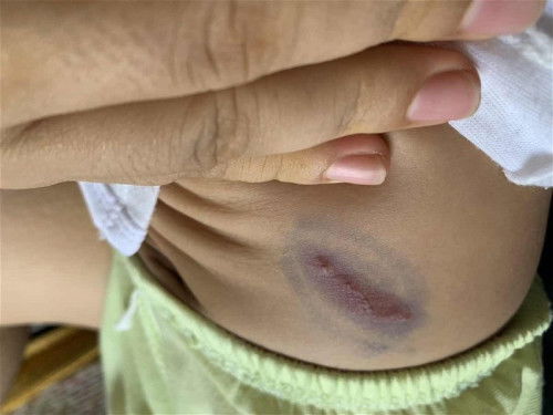 Thắc mắc mong các mom giúp đỡ