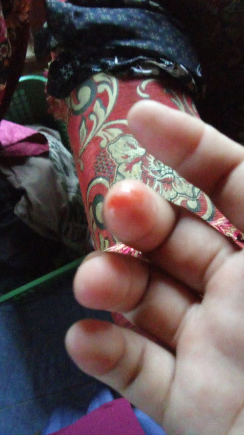 Lendir darah tapi belum kontraksi