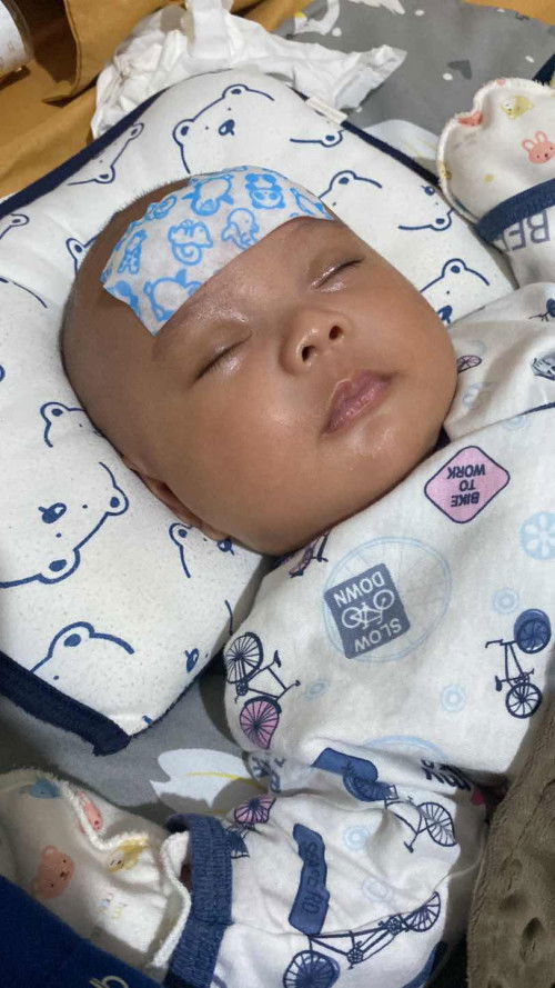 Demam pada bayi 2 bulan