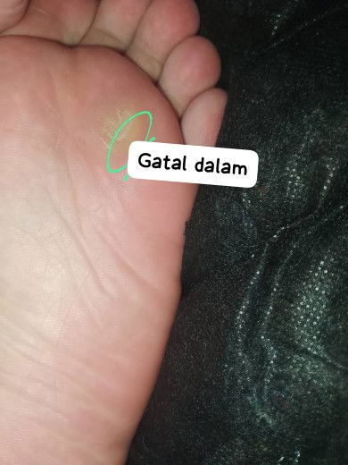 Kaki saya mcm ni kenapa