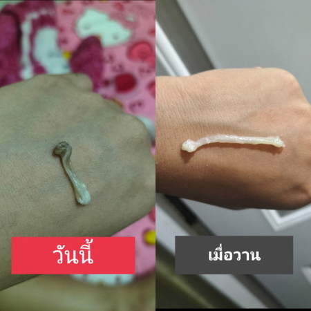 มูกหรือตกขาว?