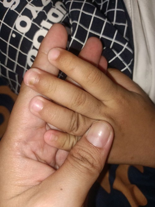 Kuku pada anak