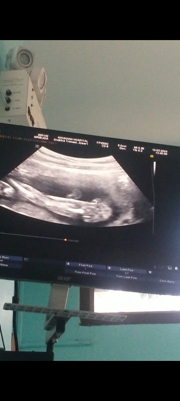 แม่ๆช่วยดูให้หน่อยว่าหนูเพศหญิงหรือเพศชาย  มีแต่คนทักว่าผู้ชาย ทีม กรกฎาคม