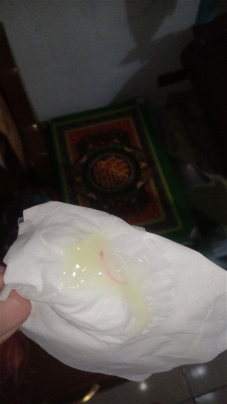 Keputihan atau tanda melahirkan