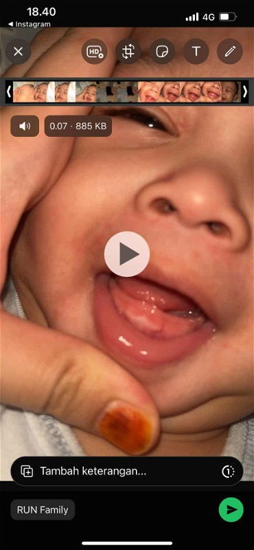 Tumbuh gigi bayi 8bulan