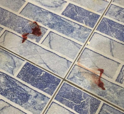 ขอสอบถามแม่ๆหน่อยค่ะ ใครเคยเป็นไหม