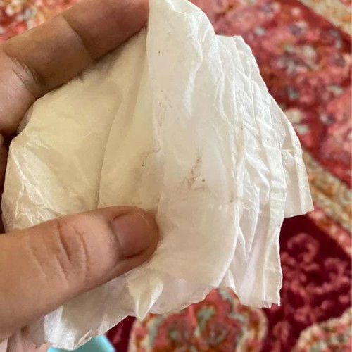 Flek kehamilan 6 week