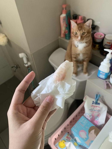 39 วีคพอดี วันนี้ตอนเช้ามีมูกแบบนี้แต่ไม่ปวดท้อง ต้องไปรพเลยมั้ยคะ
