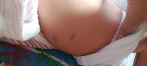 Skin problem