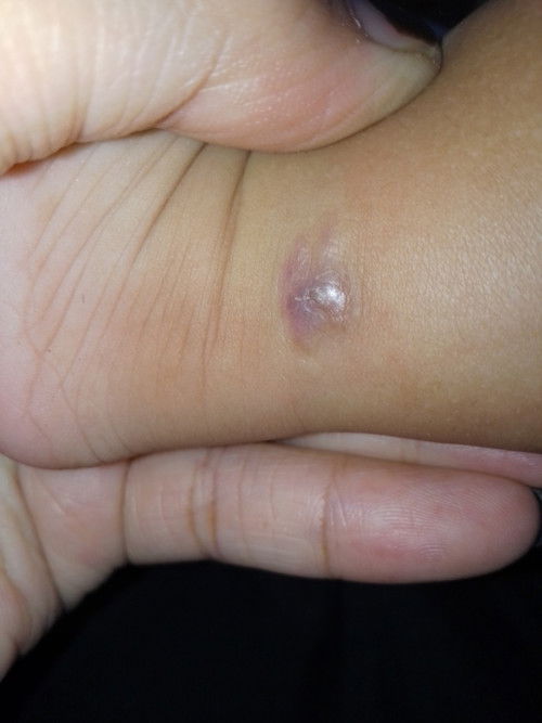 bund mau tanya bekas seperti ini