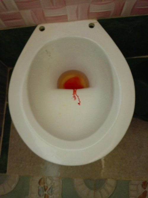 26 weeks Bleeding