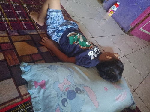 Apa bedanya campak sama flu Singapura