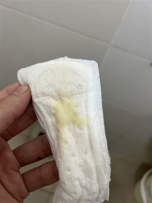 boleh tahu ni mucus plug atau tanda GBS?