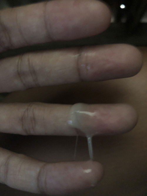 อาการใกล้คลอด