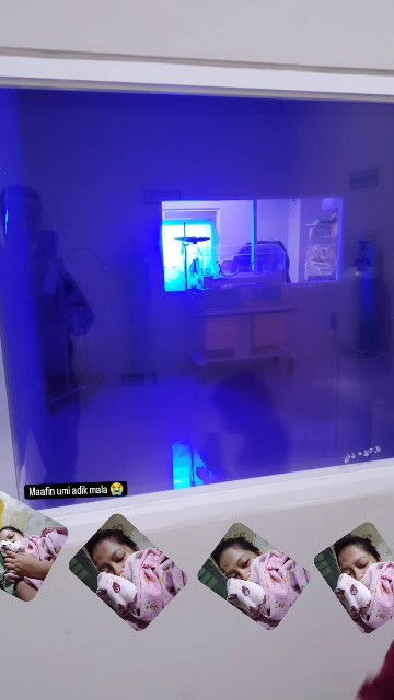 Kuning atau Hb rendah.