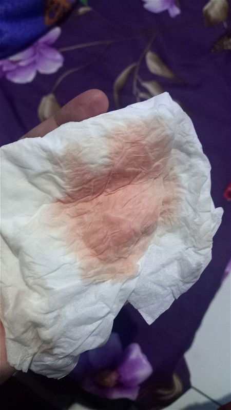 KELUAR CAIRAN MERAH MUDA DI 39w