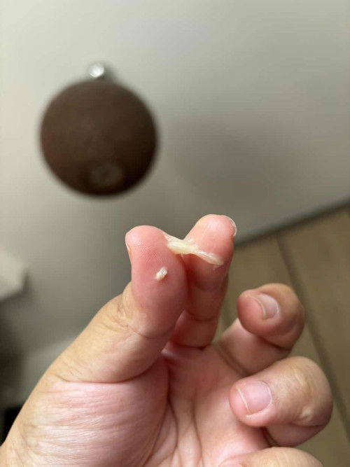 White yellow discharge