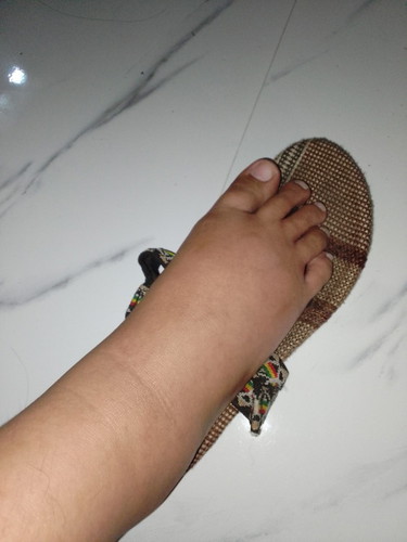 Manas at 32 weeks