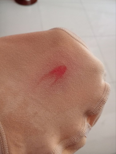Hamil 6minggu