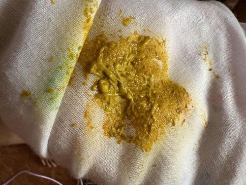 ถ่ายแบบนี้ปกติไหมคะ กลุ้มใจมากเลยค่ะ