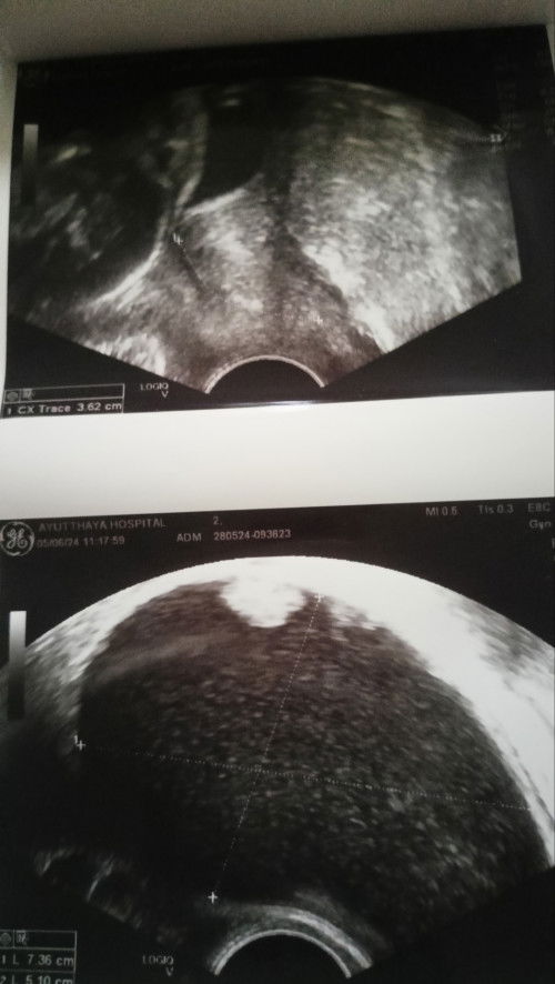 ขอสอบถามแม่ๆหน่อยจ้า