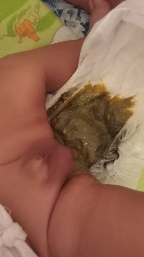 Bund maaf kalo jorok. Bayi 2 bulan bab nya bbrpa hari sprti ini.