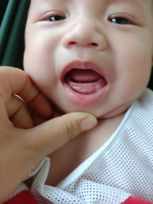 Bé nhà em 4 tháng 27 ngày hôm nay tự nhiên bú ít và ở phân nếu có nổi gì trắng trắng các mom