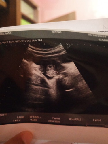 Keluar gumpalan darah hamil 7week