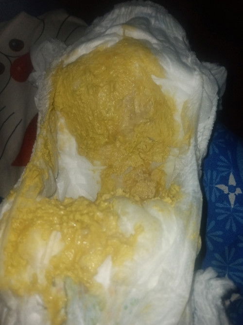 Pup lebih dari ,6 kali dalam 1 hari 
Sufor normalkah