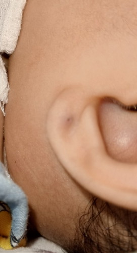 Baby ear piercing
