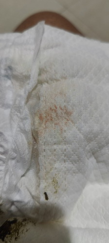 Baby's pee orange color