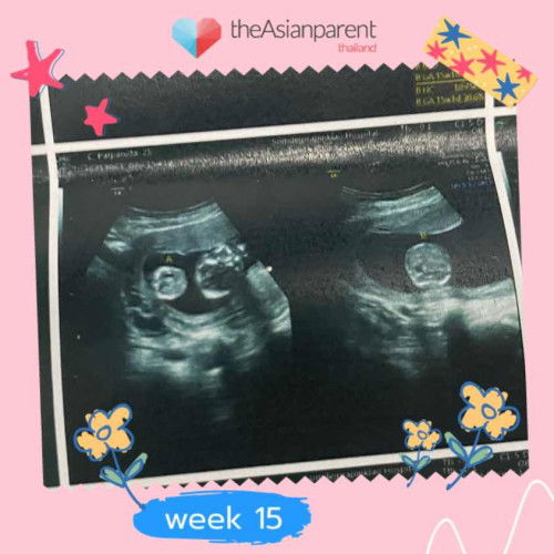 Welcome My little twin
แฝดแท้ของหม่าม๊า❤️