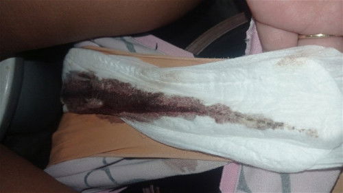 5 weeks pregnant SPOTTING