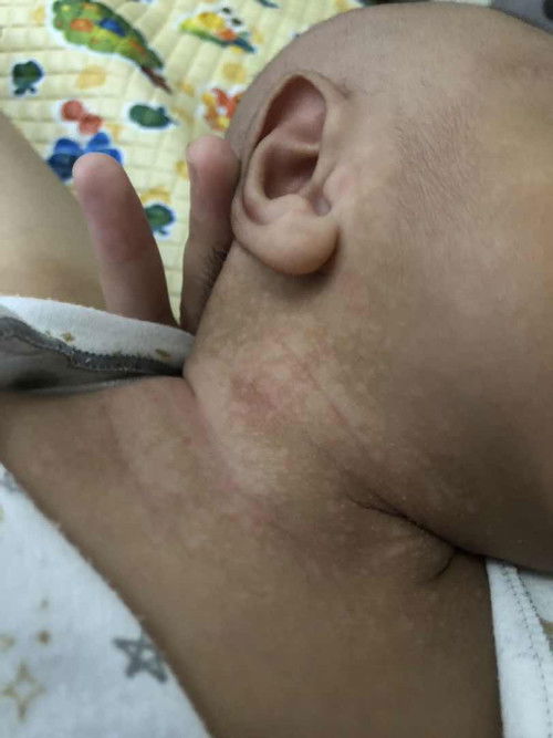 Bekas biang keringet