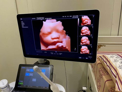 Usg 4d hpL 15 agustus