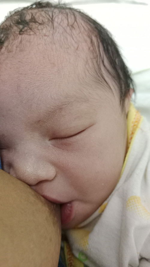 Sudah lahir dengan induksi