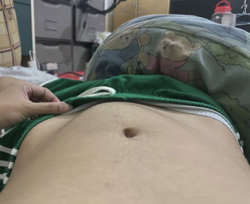 นอนหงายแล้วท้องแหลมแข็งแบบนี้คือไรคะเป็นทุกวันเลยค่ะ ท้อง14+6วีค