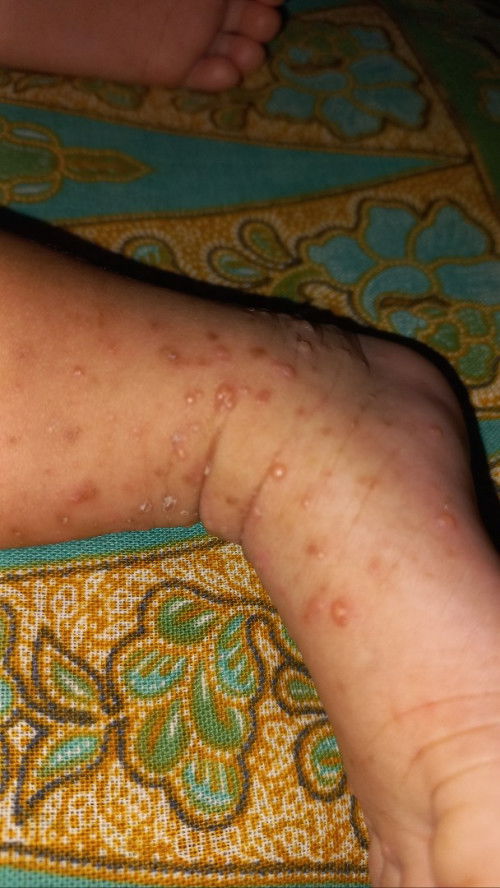 Bintik bintik ada airnya