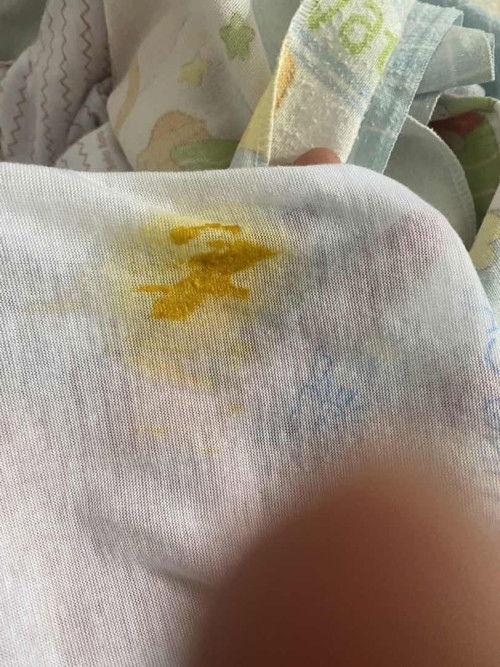 Bayi newborn ban terus setiap pipis dan kentut