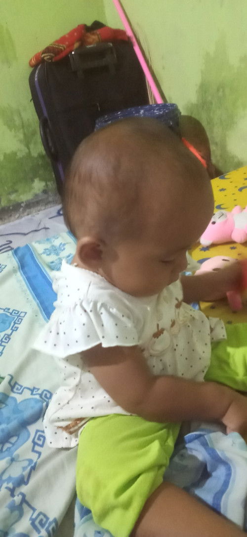 Anak 1 tahun lebih belum bisa berjalan dan berdiri serta blm bisa bangun saat posisi tdr