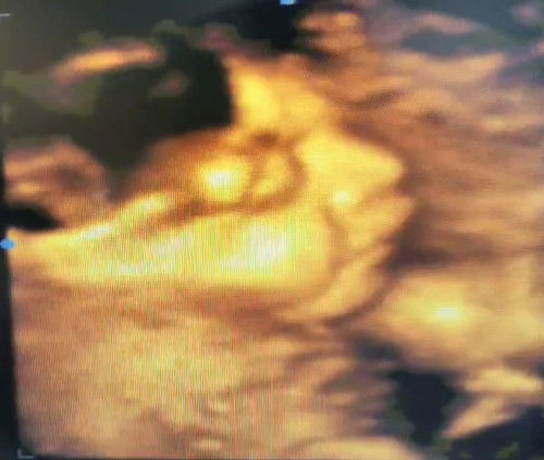 ว่าด้วยเรื่องน้ำหนักเจ้าตัวน้อย เมื่อวานนี้คุณหมอนัดตามกำหนด 28วีค