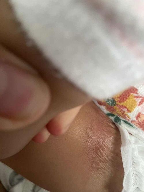 Boleh share tak lotion yang sesuai untuk kulit kering di bahagian tepi private part ?