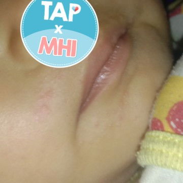 tanya dong bun, kira kira ad yg pernah ngalamin ky gini ga ya anaknya bun ..kira2ini knp ya